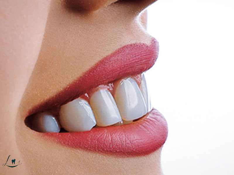 Best Countries for Dental Treatment