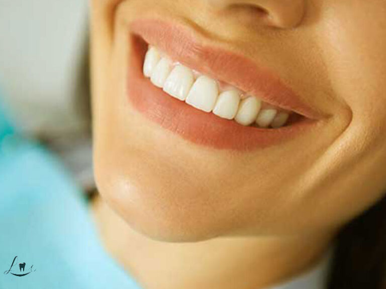 Best Smile Shape for Face Type