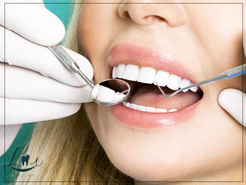 Dental implants All-on-4 Turkey