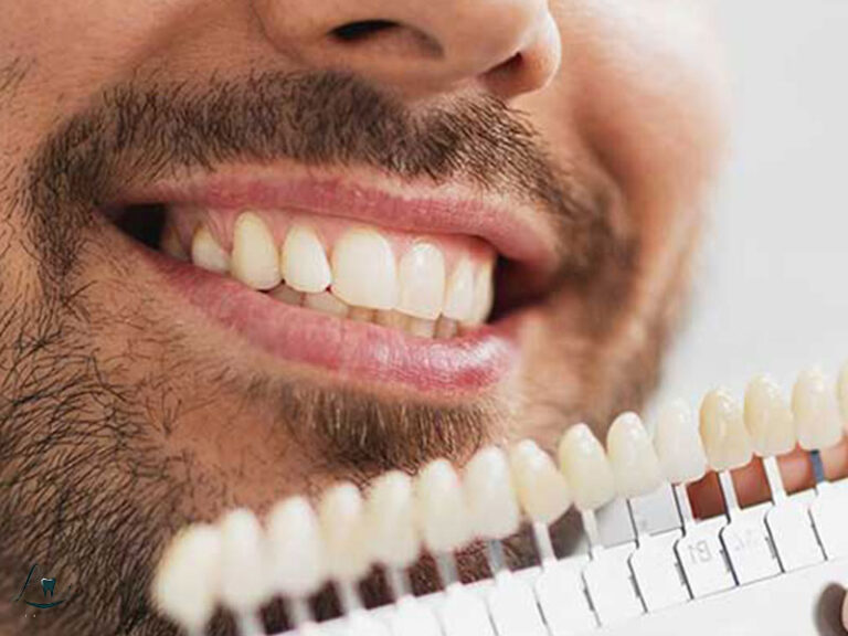 before after smile makeover