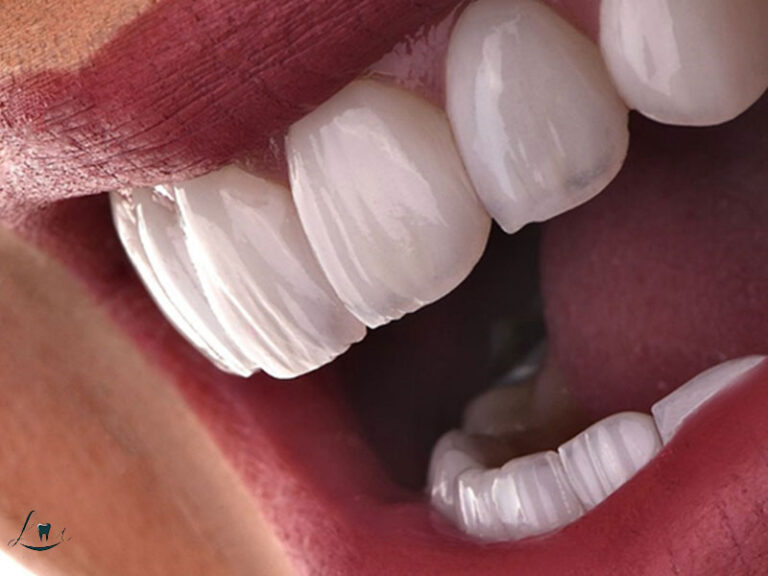 dental tourism packages explained