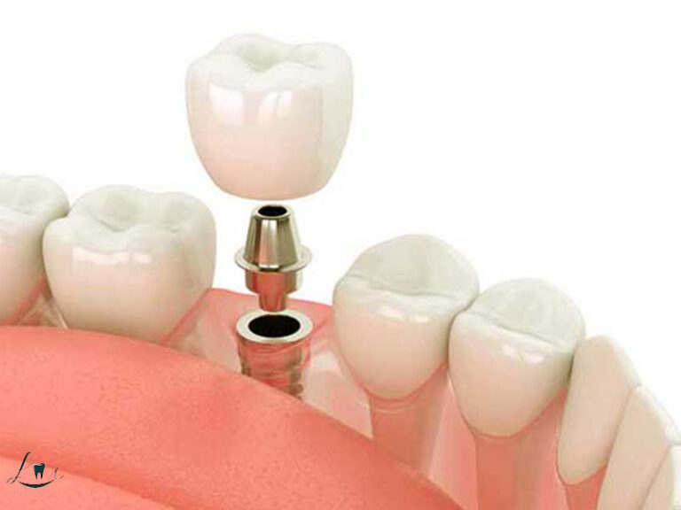 dental travel checklist