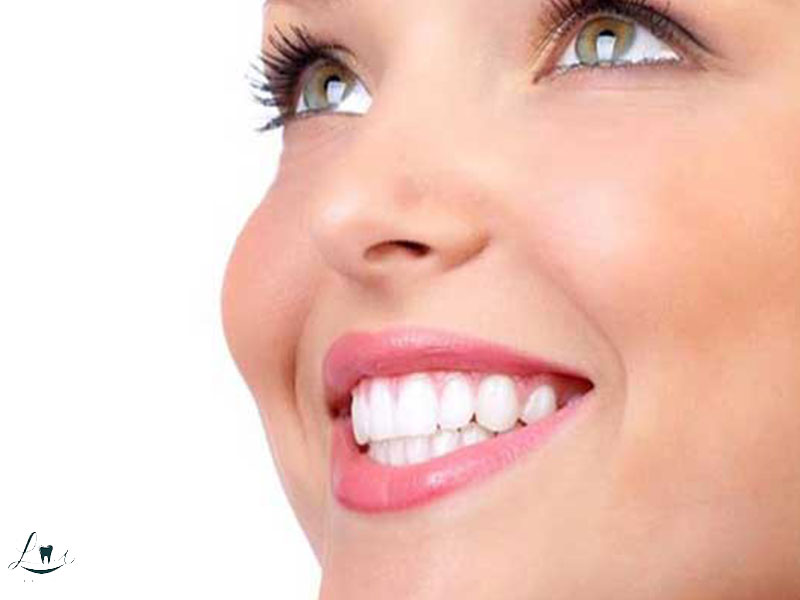 face analysis for smile design