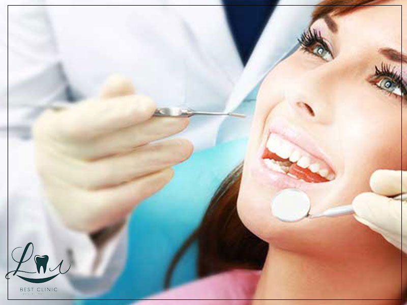 how long do veneers last