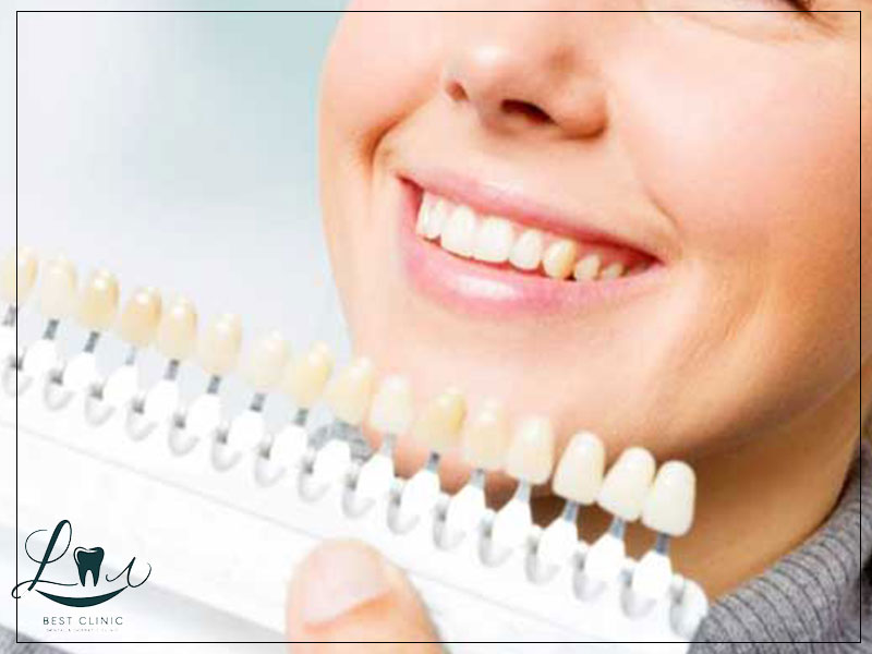 how much does hollywood smile cost