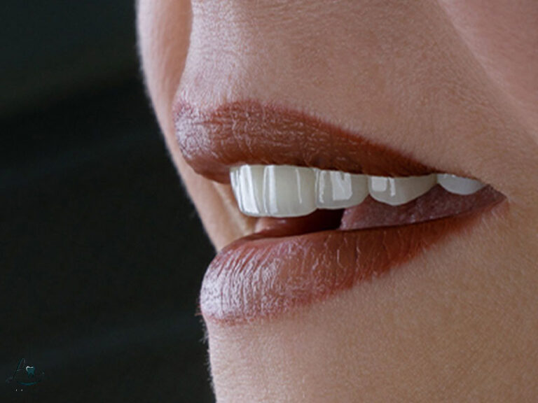 how to choose dental clinic in turkey