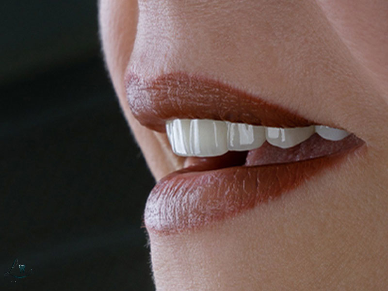 how to choose dental clinic in turkey