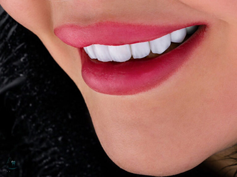 risks of getting teeth done abroad