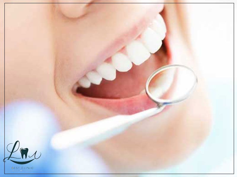 veneers vs crowns difference