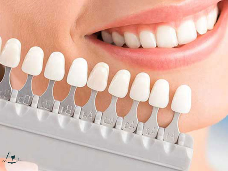 what is smile design